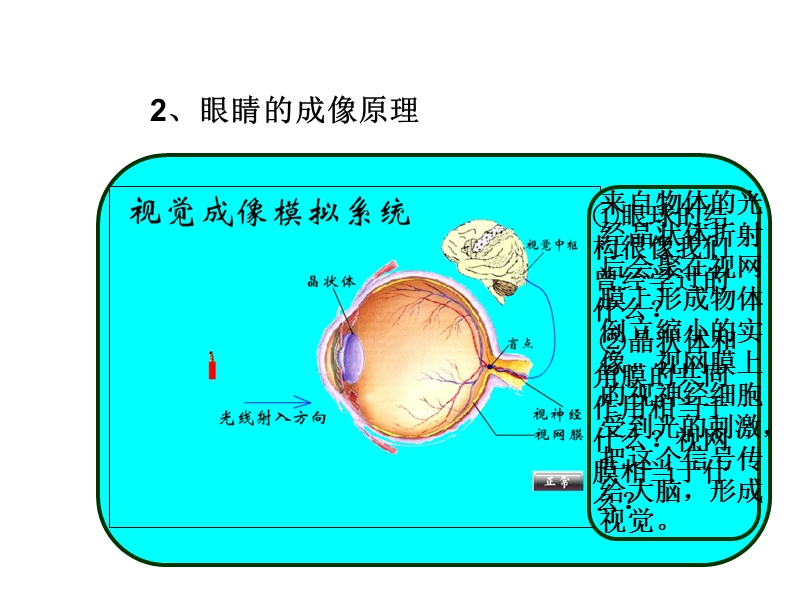 【人教版】物理八年级上册5.4《眼睛和眼镜》课件_第2页